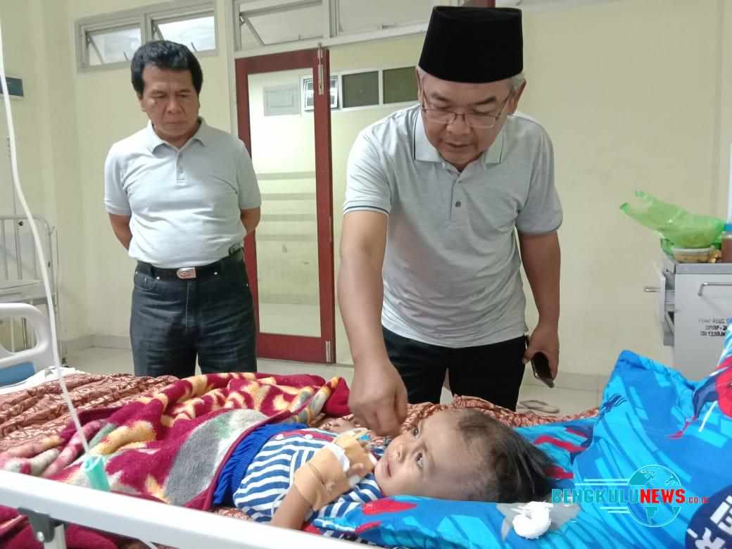 Tolong! Bayi Penderita Hidrosepalus di Curup Ini Butuh Uluran Tangan