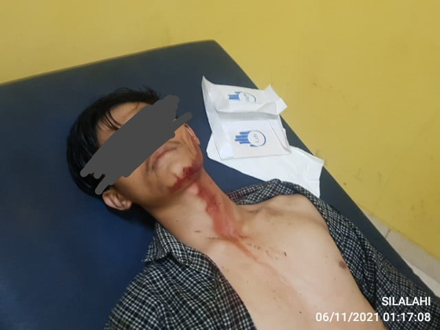 Pemuda Kepahiang Ditusuk usai Adu Mulut