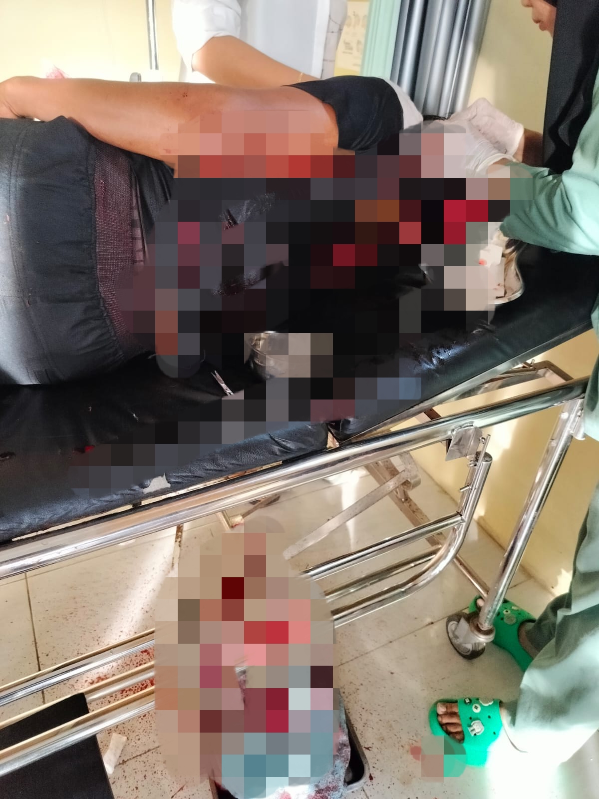 Ya Ampun, Pasutri di Bengkulu Utara Dibacok Tetangga Sendiri