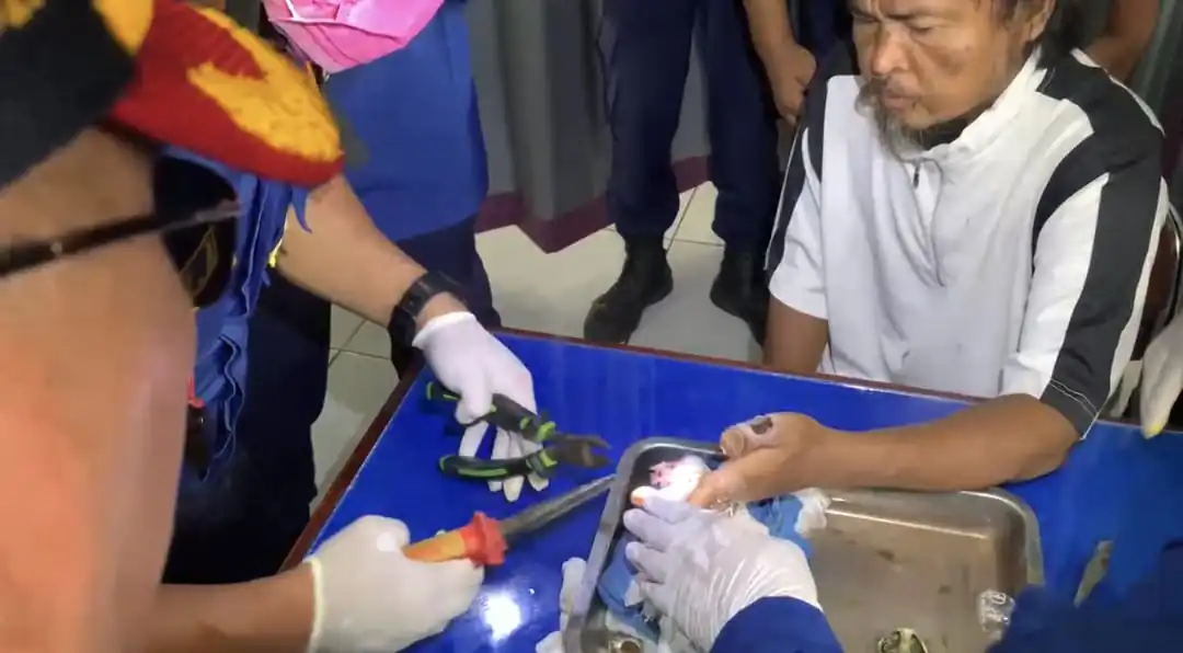 18 Cincin Akik Terjebak di Jari Pasien ODGJ, Damkar Lakukan Evakuasi Medis