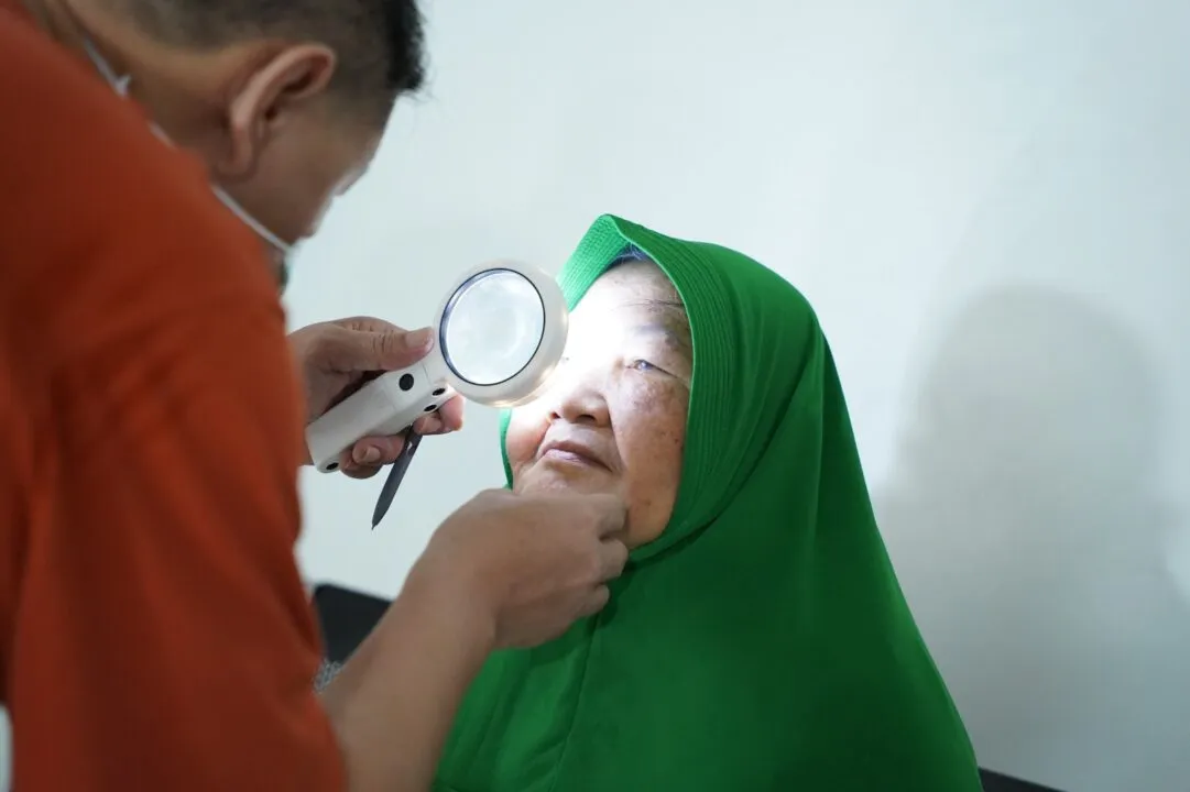 BCA dan PERDAMI Perkuat Akses Kesehatan Mata Lewat Operasi Katarak Gratis di Bengkulu